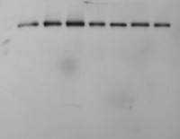 STN7 | Serine/threonine-protein kinase STN7 (chloroplastic) in the group Antibodies Plant/Algal / Photosynthesis / Kinases at Agrisera AB (Antibodies for research) (AS16 4098)